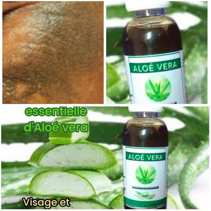 Huile d'Aloé Vera
